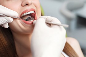 Dental exam for female patient with attractive teeth